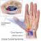 arthritis knee pain