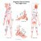 fibromyalgia treatment